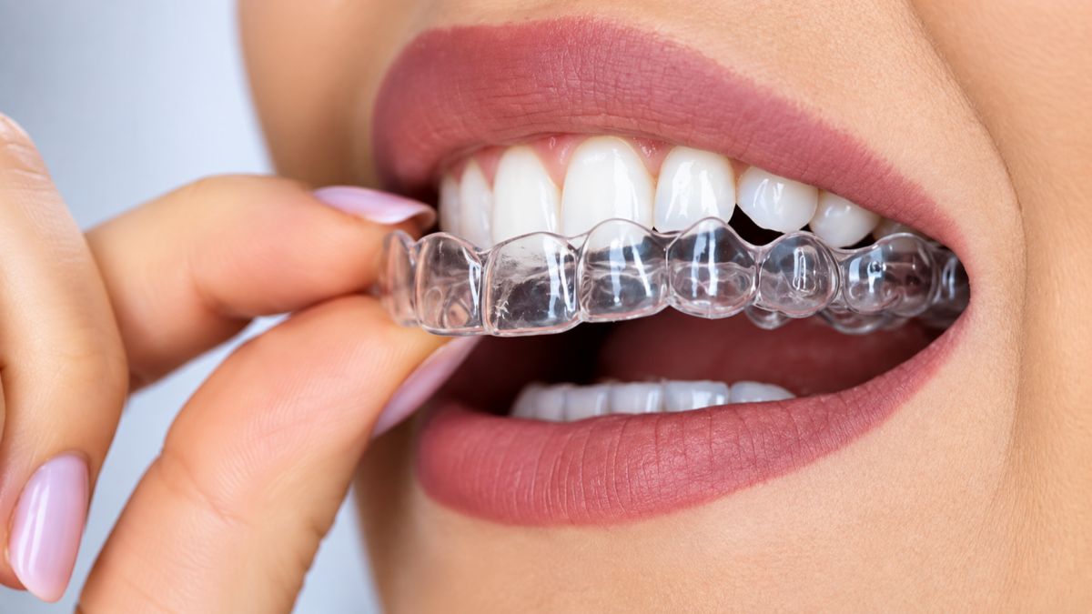 front teeth correction,  dr hileri mori,  front teeth gap closure,  smile design punawale,  dental veneers pune,  crooked front teeth repair,  front teeth bonding,  teeth alignment without braces,  cosmetic dentistry pune,  harmony dental clinic punawale